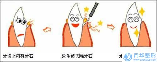 中國溶脂溶脂減肥醫(yī)院推薦：溶脂溶脂減肥醫(yī)院前50位攻略