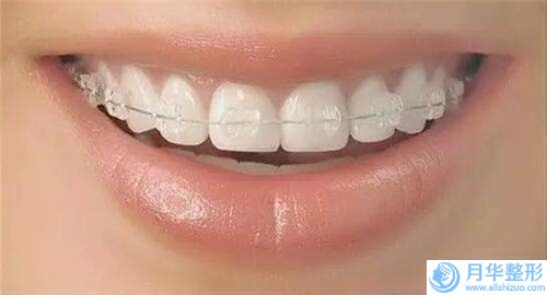 邵陽德美醫(yī)療整形美容醫(yī)院費(fèi)用表明細(xì)全新呈現(xiàn)-吸脂案例