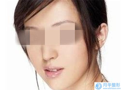 福州第二醫(yī)院整形外科胸廓整形手術(shù)價格大概是多少錢