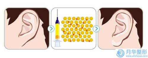 做男人乳頭縮小的醫(yī)院推薦：男人乳頭縮小醫(yī)院top30強(qiáng)哪家較好