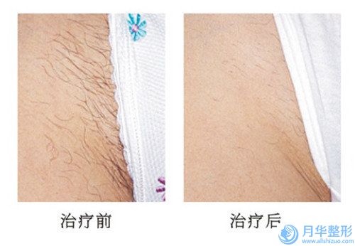 邵陽瑞鉑醫(yī)療美容價格(收費標(biāo)準(zhǔn))熱門項目爆出-面部提升童顏術(shù)案例