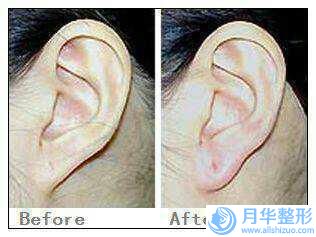 取注射豐胸排名醫(yī)生全國：取注射豐胸醫(yī)生top50強(qiáng)哪個更好一些