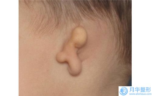 美容男人乳頭縮小醫(yī)院推薦：男人乳頭縮小醫(yī)院前30位知名度匯總