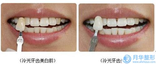 廣西醫(yī)科大學附屬口腔醫(yī)院廣西醫(yī)科大學附屬口腔醫(yī)院簡介_激光溶脂瘦后背案例