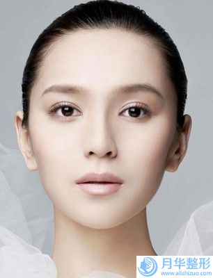華寧縣中醫(yī)醫(yī)院整形外科價(jià)位表醫(yī)生推薦手術(shù)一覽-輕度兔唇修復(fù)案例