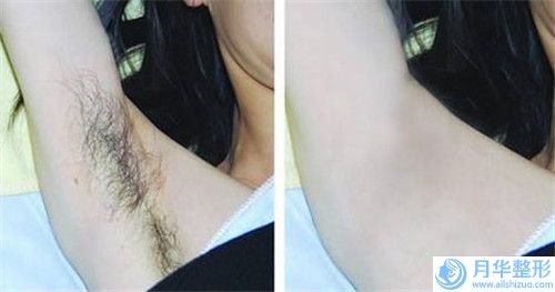 哈爾濱醫(yī)科大附屬第四醫(yī)院美容整形科以面部抽脂吸脂手術(shù)著稱，效果好嗎