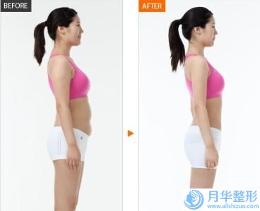 下顎角過大溫州市的整形醫(yī)院(溫州市系美醫(yī)療美容是人氣高的)