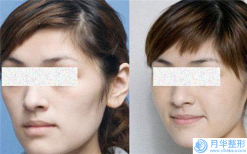 久e紋眉的維持時間是好久,久e紋眉術怎么樣可以維持多久