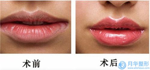 盤(pán)錦北方醫(yī)療美容診所價(jià)格(價(jià)目)2024爆肝一覽-抽脂除雙下巴案例