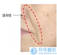 吳漢江整形醫(yī)生-長沙市吳漢江醫(yī)生彩光嫩膚去老年斑實(shí)力與口碑優(yōu)選