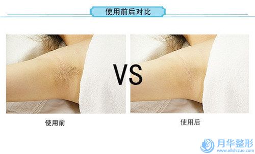 安達(dá)利達(dá)醫(yī)院皮膚美容整形科價格(收費標(biāo)準(zhǔn))2024參考-做面部疤痕修復(fù)案例