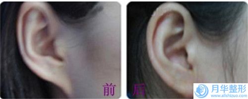 大連市整形做隆胸比較好醫(yī)院(大連市第三人民醫(yī)院整形科技術_口碑_價格刷屏)