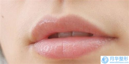 牙貼面瓷貼面的過(guò)程及適應(yīng)人群