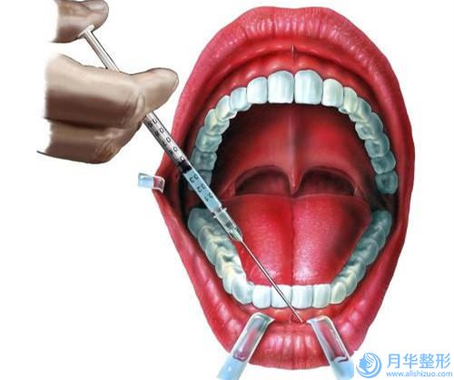 承德大腿超聲吸脂術價格因素解析