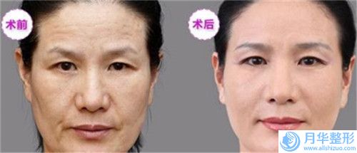 望江縣人民醫(yī)院價(jià)格價(jià)位表說明-漂唇顏色不均勻案例