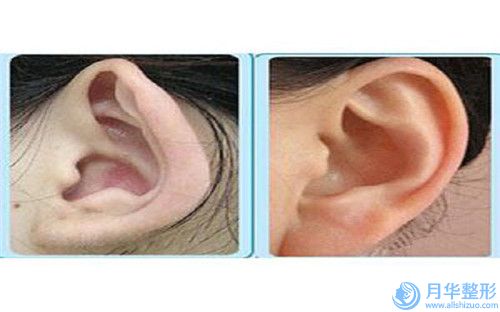 全國斷奶后乳房恢復醫(yī)院推薦：斷奶后乳房恢復醫(yī)院50強深度點評