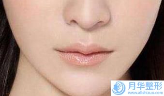 福州市墊下巴美容價(jià)格價(jià)位表有名傾情巨獻(xiàn)(墊下巴美容一般貴不貴)