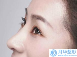 國內(nèi)用豐下巴醫(yī)院推薦：用豐下巴醫(yī)院top50全新盤點