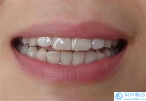 大慶龍南醫(yī)院整形外科腰兩側(cè)吸脂手術(shù)整形費用大概是多少錢