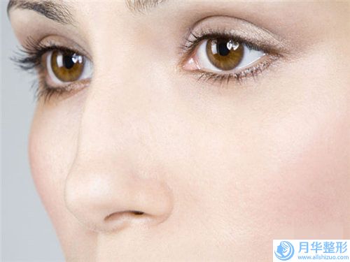 德州眾美整形美容整形價(jià)位表2024項(xiàng)目-寬鼻縮窄案例