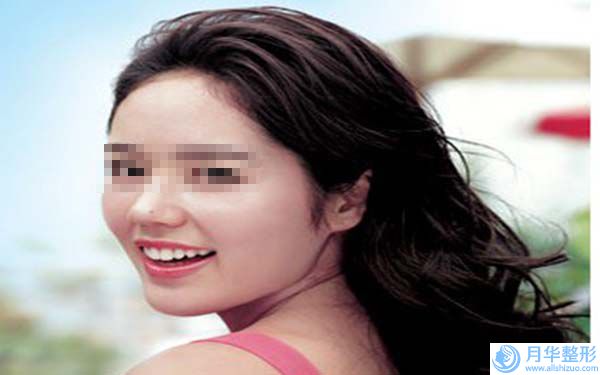廣州安麗維整形美容整形價格價位表2024新版來襲-手術(shù)去除雙下巴案例