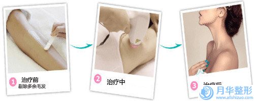 陸軍第81集團軍醫(yī)院-整形美容科價格(價目)表超人氣項目全面一覽-美白針手術(shù)案例