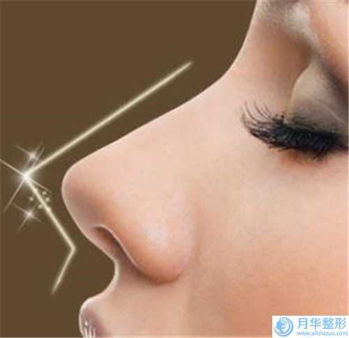 嘉興市婦幼保健院整形價位表官網(wǎng)正規(guī)2024上線-快速隆鼻案例