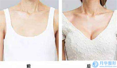 蚌埠市額肌筋膜瓣懸吊矯正整形醫(yī)院上榜名單當(dāng)?shù)乜诒?蚌埠娜美醫(yī)療美容門(mén)診一一上榜)