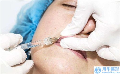 江西省趙杰發(fā)整形醫(yī)生面部假體隆下巴費用是怎么定