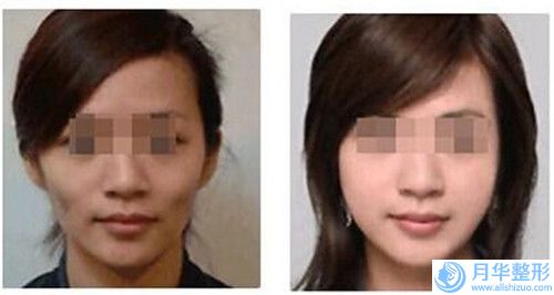 九江市毛發(fā)種植睫毛收費明細全新真實強勢曝光-九江市毛發(fā)種植睫毛一次要花多少價格呢