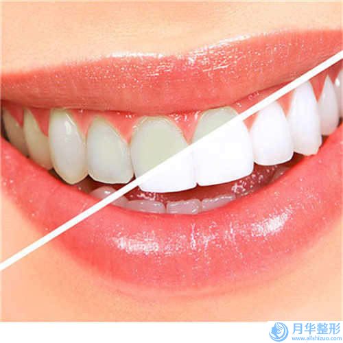 常州眶隔脂肪解剖費(fèi)用跟哪些因素有關(guān)