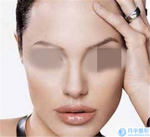 延安肋骨鼻隆鼻整形對身體有傷害沒