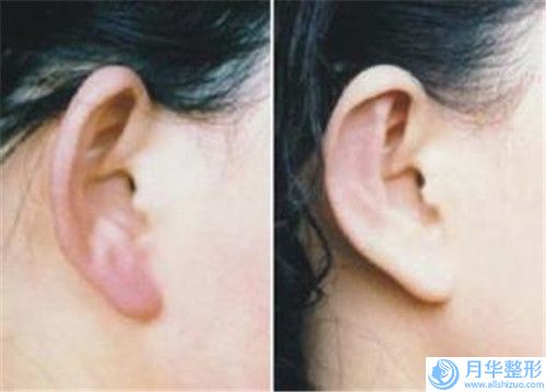 國內男性乳房吸脂醫(yī)院推薦：男性乳房吸脂醫(yī)院top50哪幾個技術強