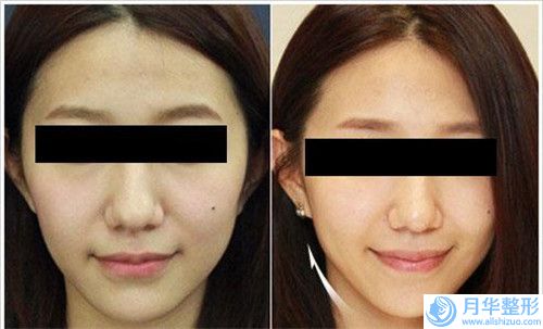 合肥市文個(gè)眉價(jià)格(價(jià)目)全部項(xiàng)目正規(guī)官方2025釋出-合肥市文個(gè)眉治療費(fèi)用