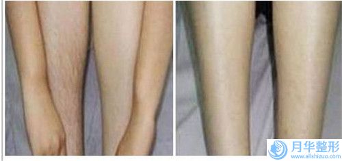 福建三明梅列十博悅口腔門診部價格表參考_醫(yī)生介紹-鑲?cè)少N面牙花費(fèi)要多少