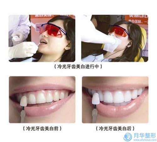 遼寧省小孩皮脂腺痣手術(shù)醫(yī)生哪位實力強-劉寶山整形醫(yī)生實力不可小覷