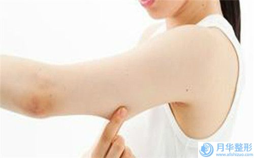 六盤水面部提升整形整形手術(shù)會影響正常生育嗎