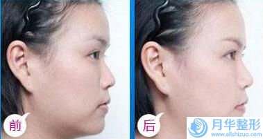 盤錦琇云醫(yī)療美容門診做隆胸修復(fù)費(fèi)用大致多少