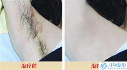 蚌埠市整形切痣價(jià)格(費(fèi)用)清單2024全面曝光(整形切痣費(fèi)用多少錢呢)