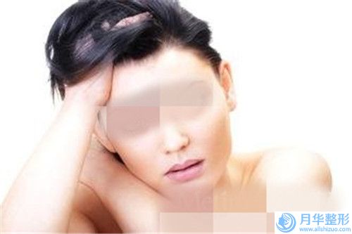 南平紋唇線后能管多長時間,南平紋唇線術維持時間久不久