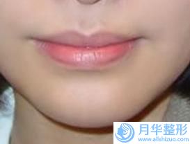徐州心源醫(yī)療整形美容?？漆t(yī)院徐州心源醫(yī)療整形美容?？漆t(yī)院醫(yī)生擅長下巴注射