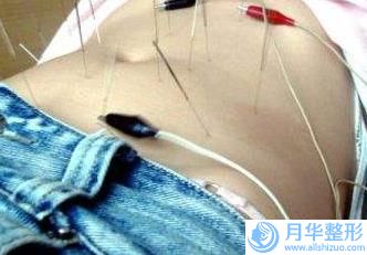 福州貝爾醫(yī)學(xué)美容醫(yī)院價格(收費標準)2025優(yōu)惠詳情一覽-上顎抬起案例