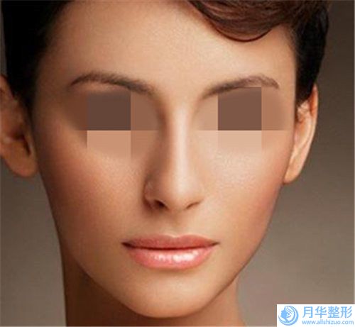 保定女性隆鼻術(shù)以后能保持多久