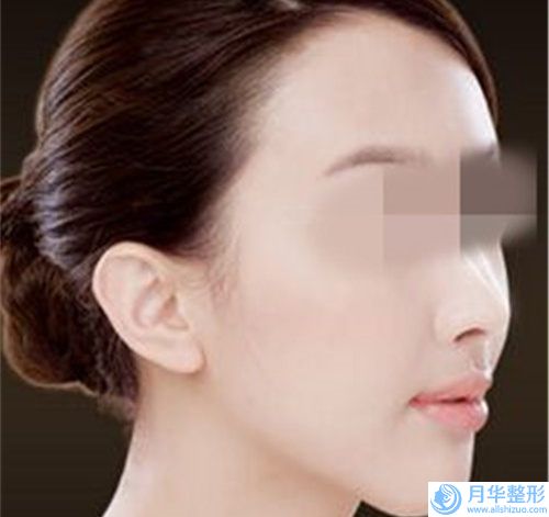 常州私人訂制豐胸效果會不自然嗎