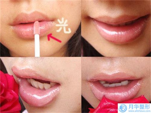 郴州星美域醫(yī)療美容自體脂肪隆下巴貴價格有優(yōu)惠嗎