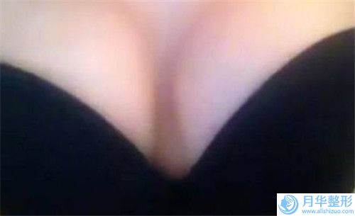 北京新極點醫(yī)療美容門診部能有效地改善縮額頭手術(shù)問題