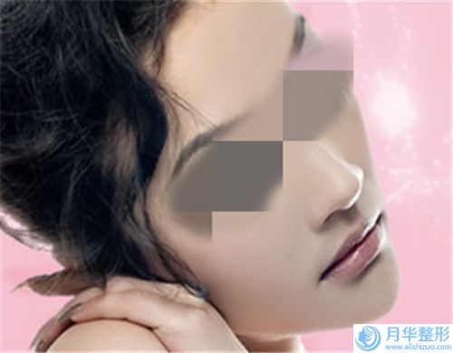 鄭州明星整形美容醫(yī)院兔唇唇腭裂修復(fù)收費(fèi)怎樣