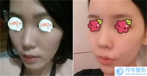 合肥男眉紋繡手術(shù)的價(jià)格是高是低