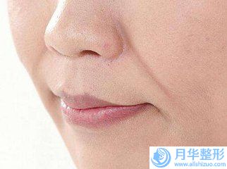 宜春治療鮮紅斑痣術(shù)可以保持多久，有什么優(yōu)勢