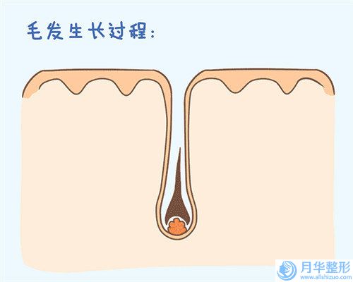 當(dāng)陽奧萊美諾醫(yī)療美容診所整形收費(fèi)明細(xì)2025洗心革面-腋臭去腋毛案例
